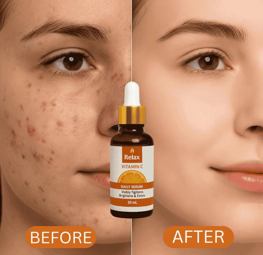 Relax Vitamin C Daily Face Serum – Brightening, Anti-Aging & Hydrating Formula(30ml)